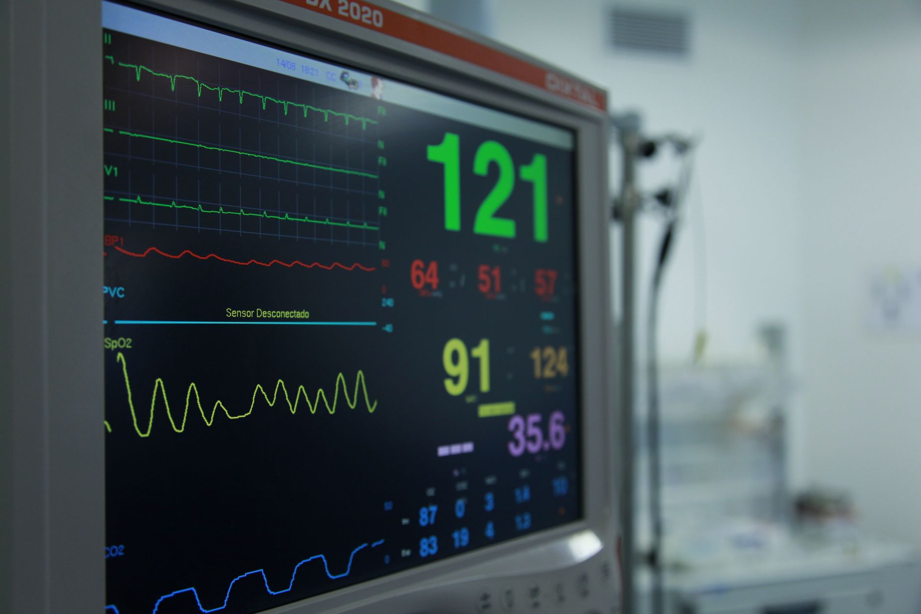 Close-up of a smartwatch displaying an ECG reading on its screen, illustrating medical-grade health monitoring
